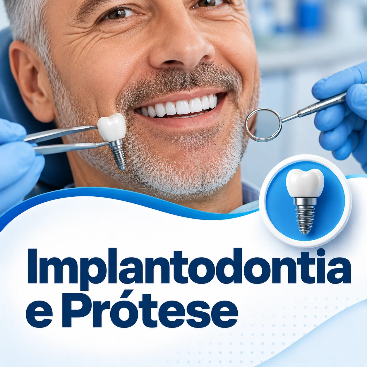 Implantodontia e prótese